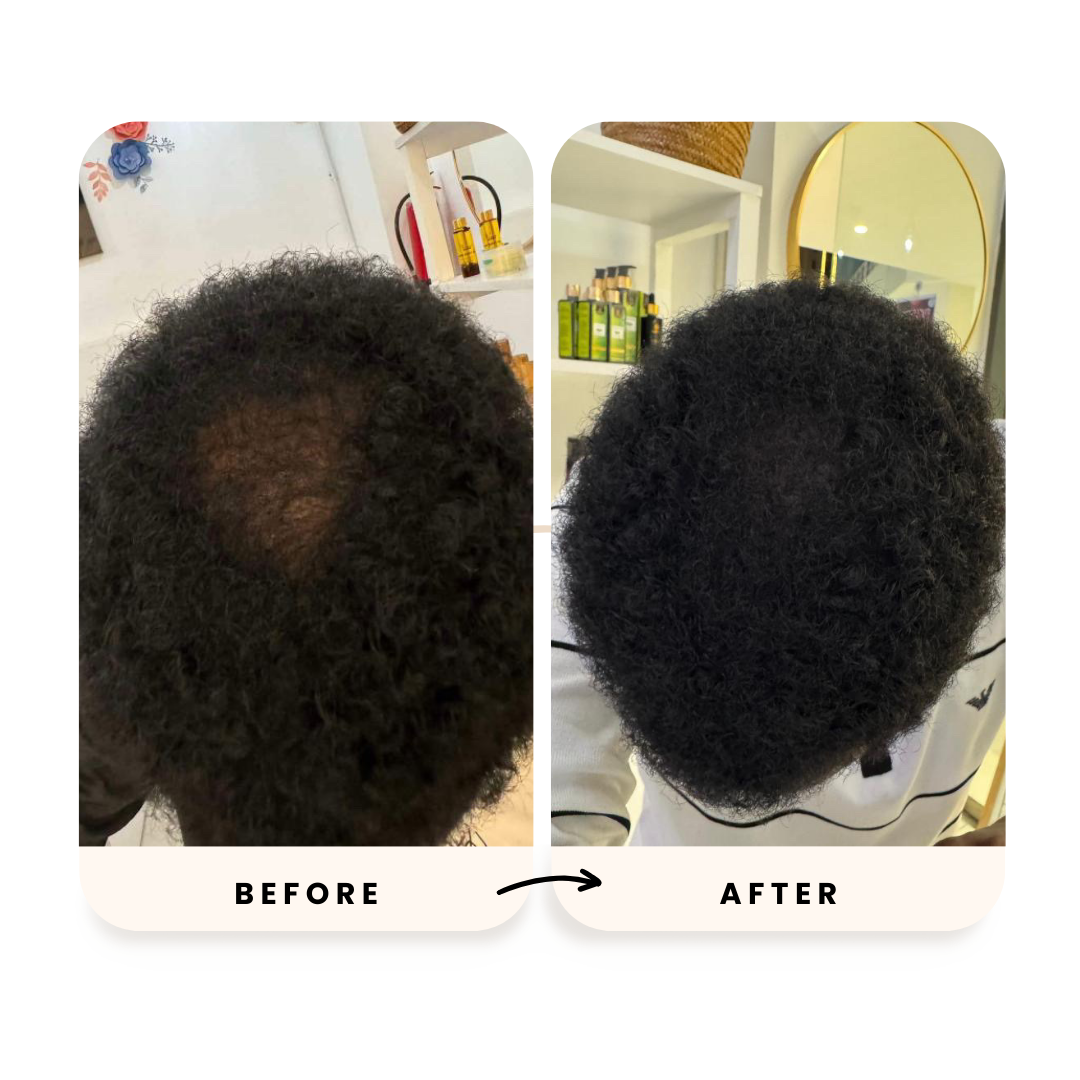 Amla and Basil 3-Step Hair Growth Kit