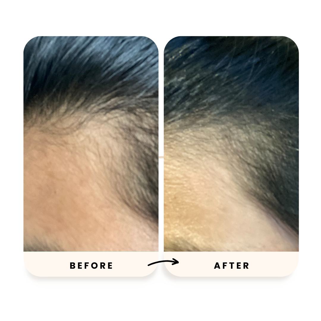 Amla And Basil 90 Day Hair Serum Pack